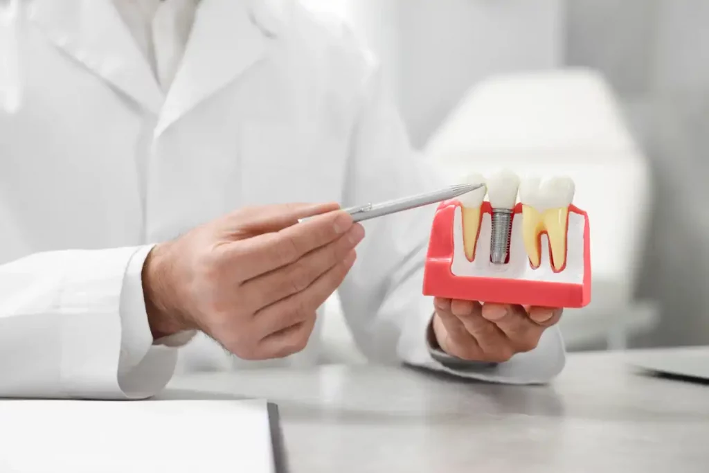 dental-implants-vs-dentures-which-is-right-for-you