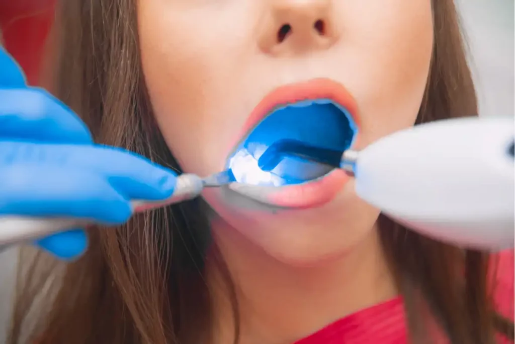 understanding-the-benefits-of-laser-dentistry/