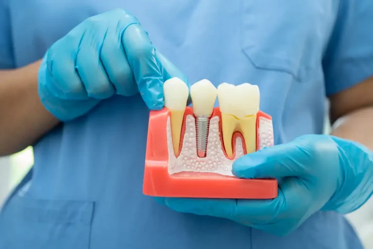 dental-implants-a-reliable-solution-for-missing-teeth
