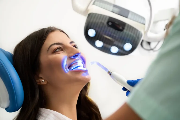 Professional Teeth Whitening