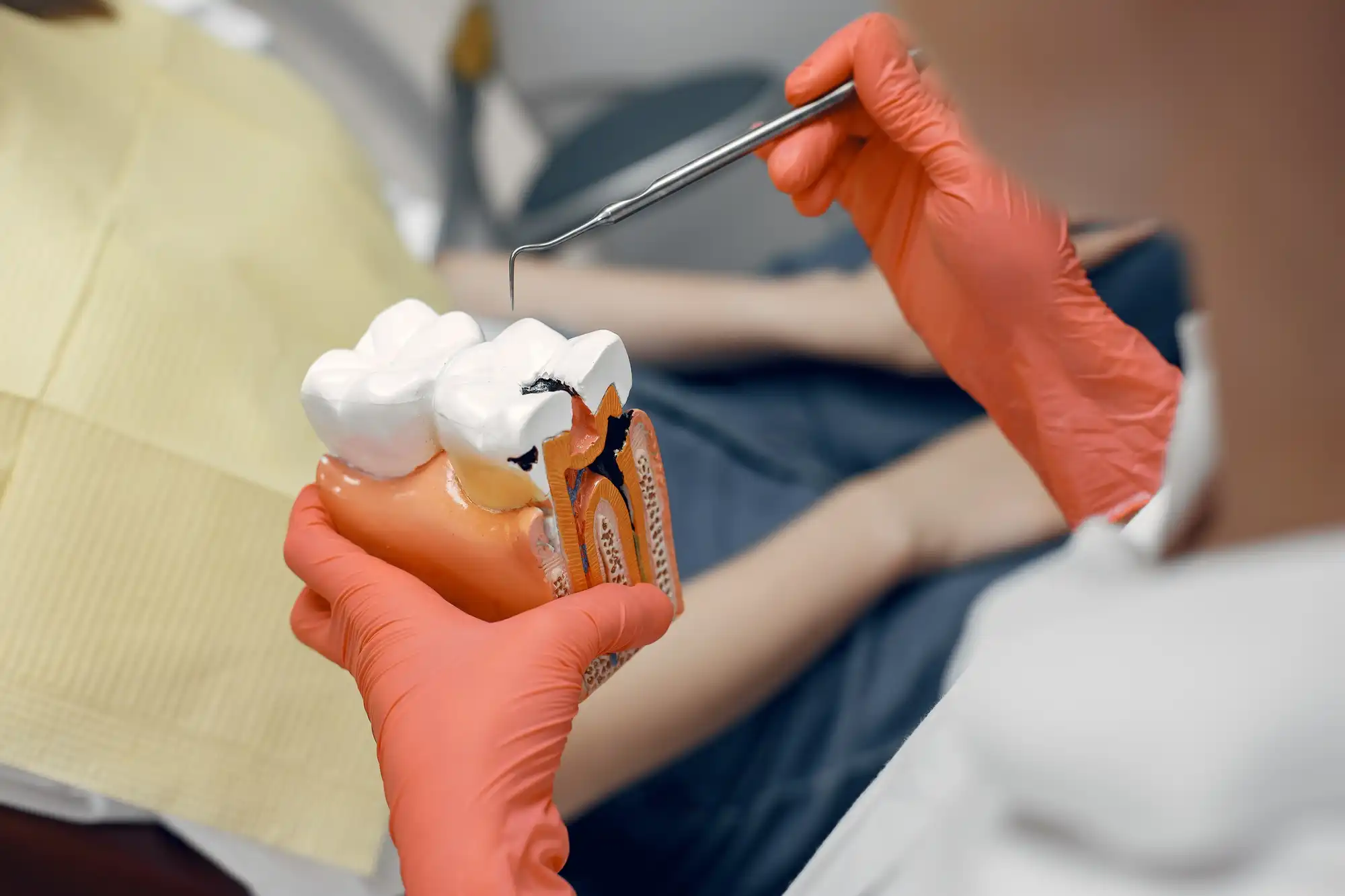 Timberridge_Root_Canal_Treatment