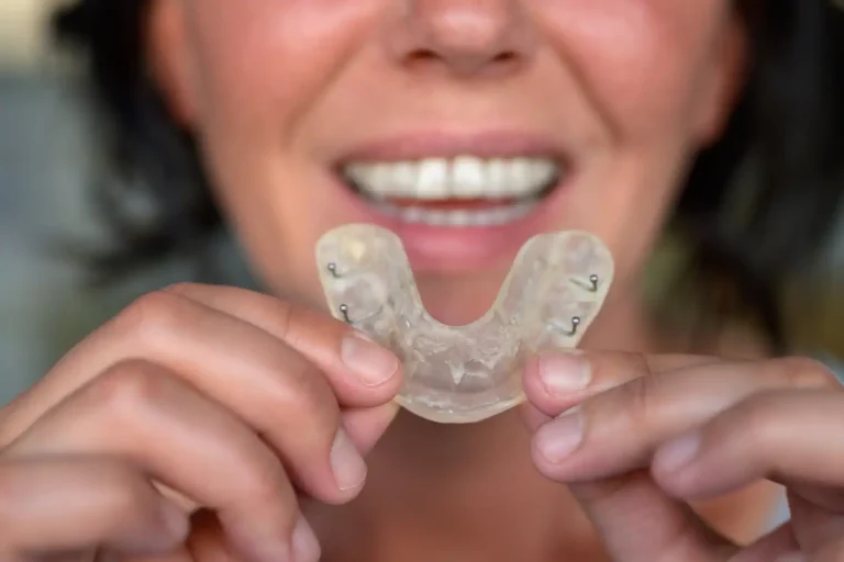 Why Mouthguards Matter