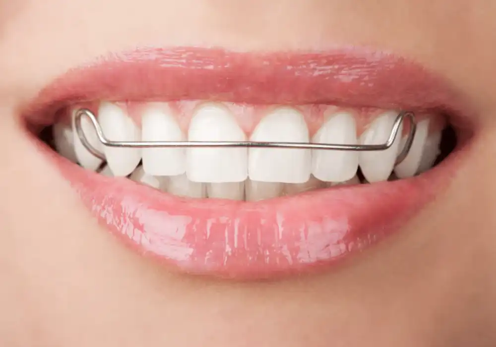 retainer