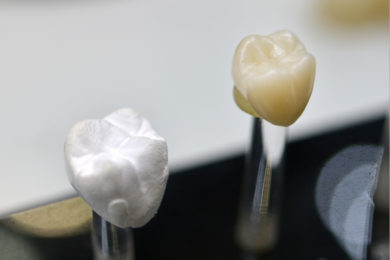 Dental Crowns