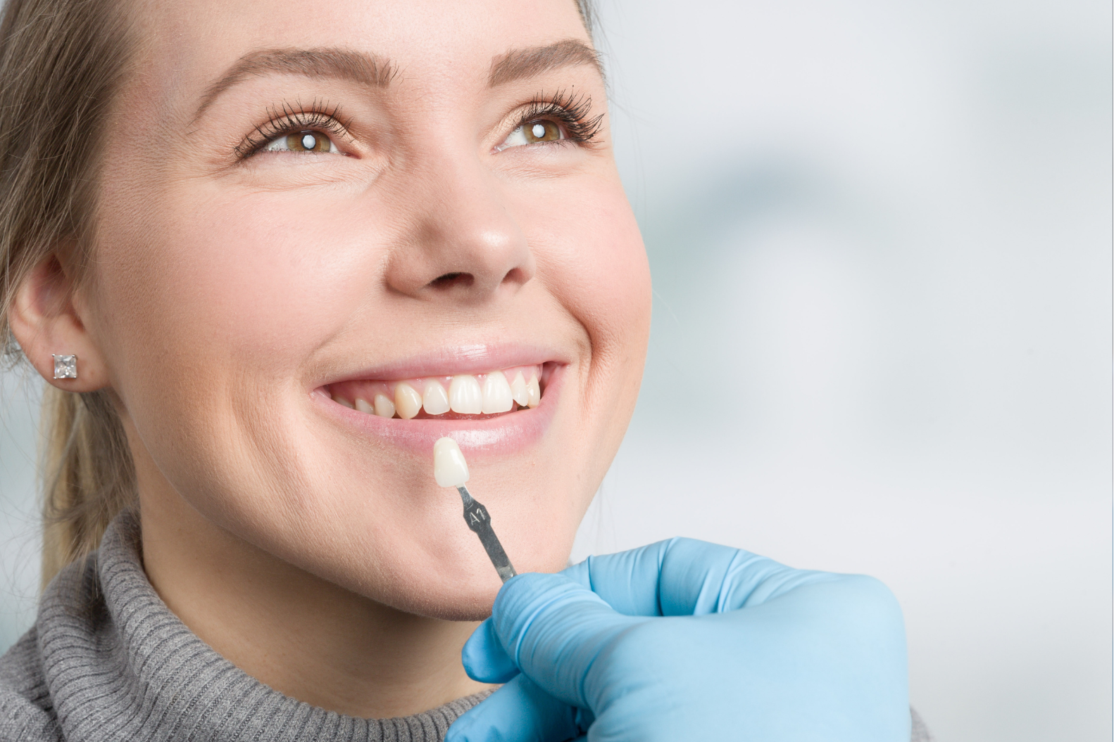 Dental Veneers